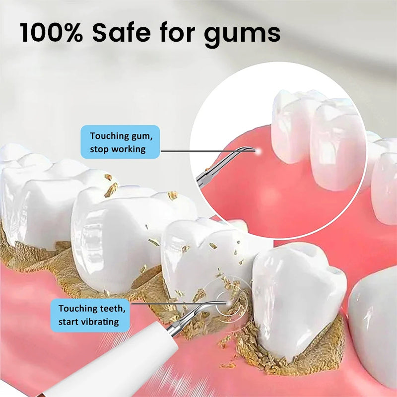 Teeth Flosser