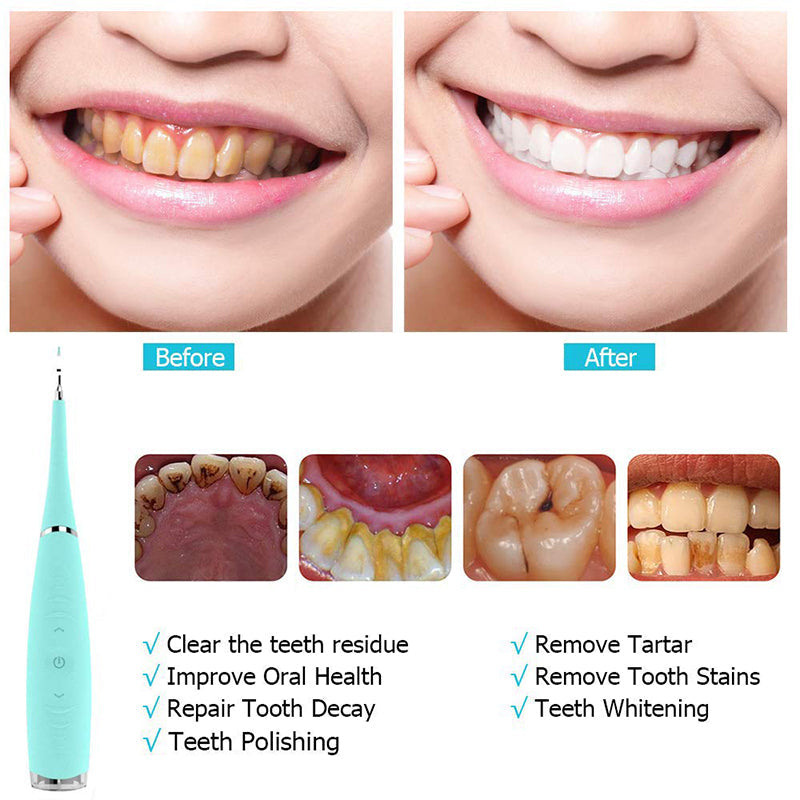 Teeth Flosser