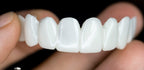 Dental prosthesis
