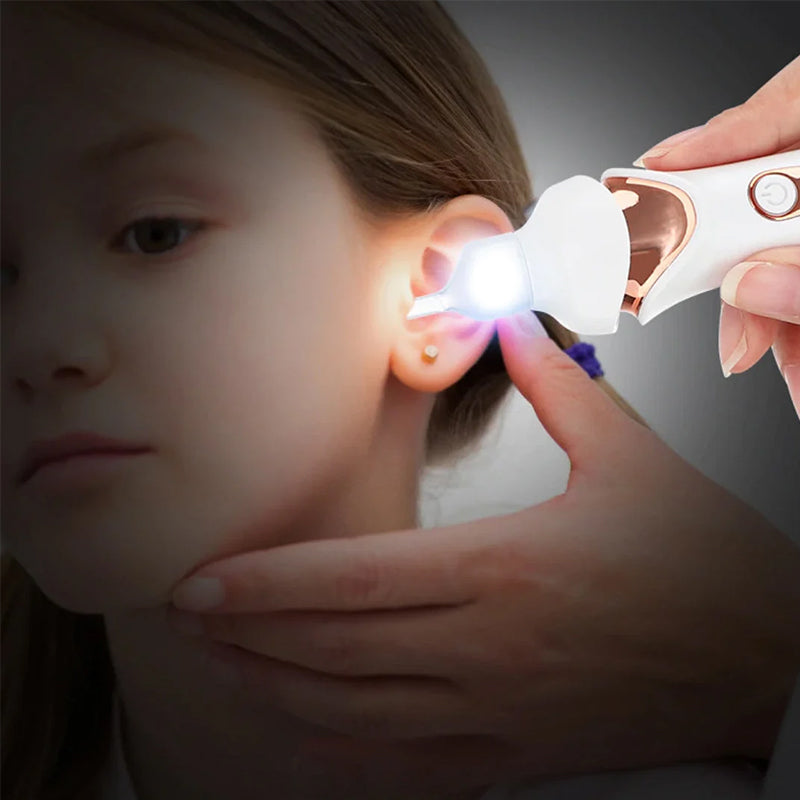 5 in 1 Electric Ear Wax Remover