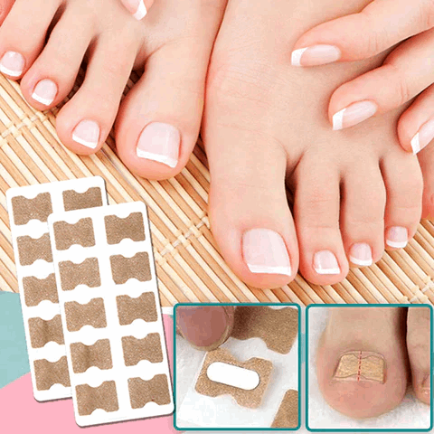 ProFlexiPatches — Pain-free natural nails that you show off again with pride