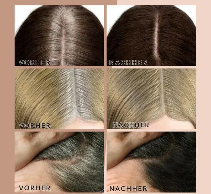 HairHalo – Perfect hairlines anytime
