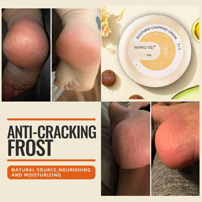 Winter Anti-Rip Frost