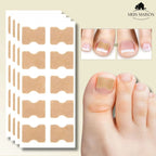 Gentle nail correction against ingrown nails & pain