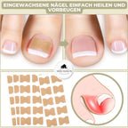 Gentle nail correction against ingrown nails & pain