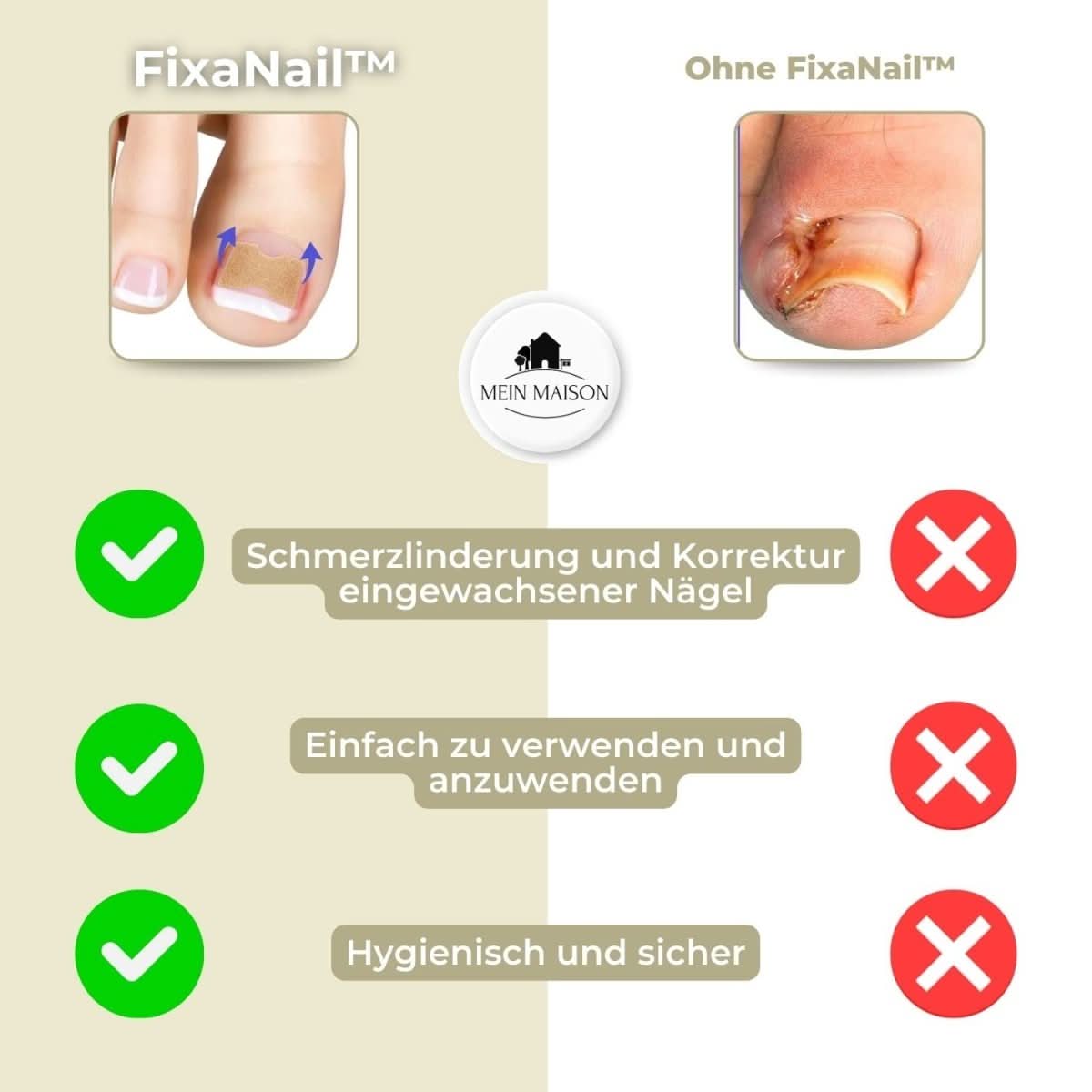 Gentle nail correction against ingrown nails & pain