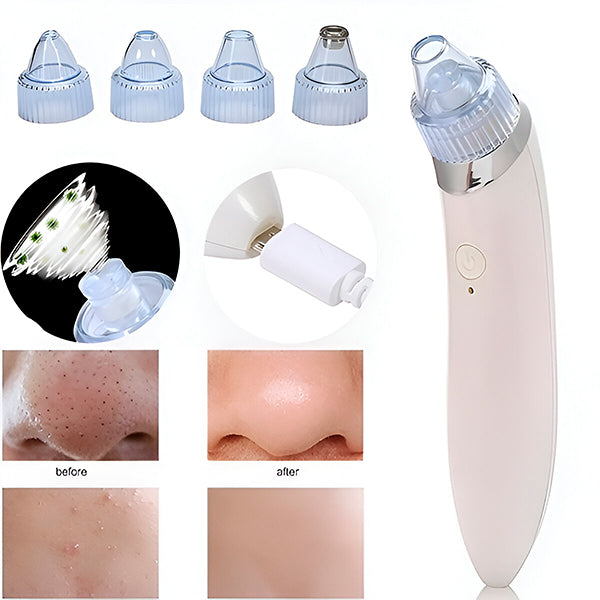 2-in-1 Pore Cleanser and Microdermabrasion Device