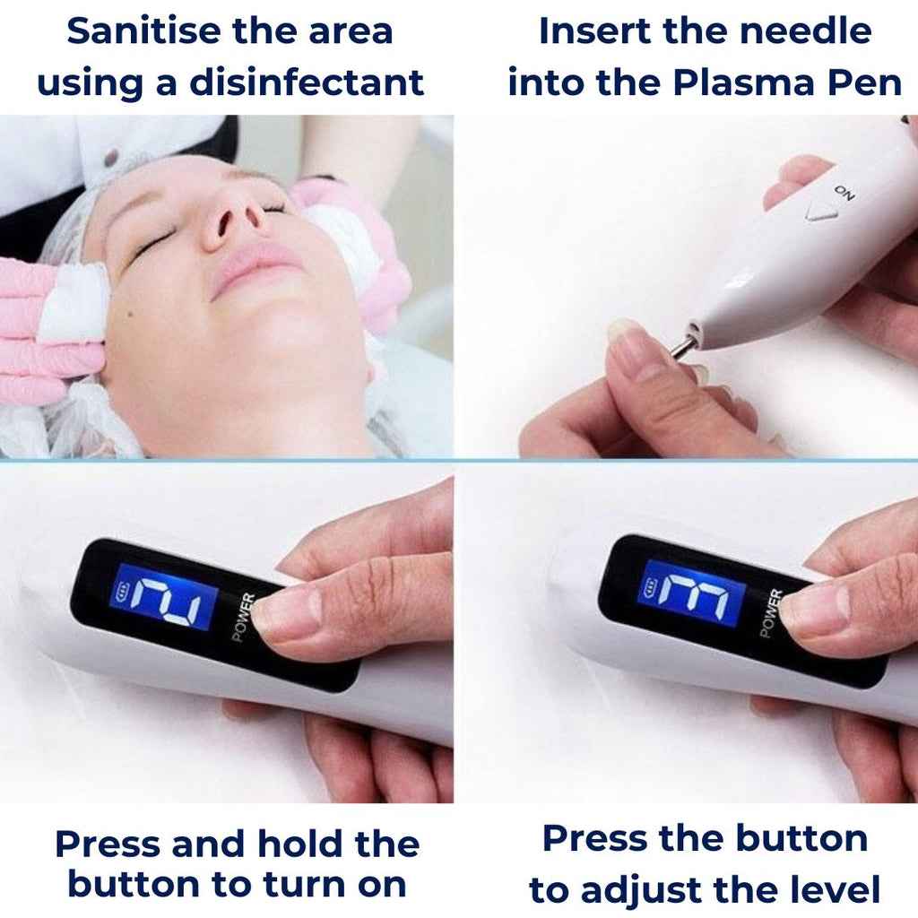 ClearSkinPro Laser Plasma Pen - Non-Invasive | for Freckle, Skin Tag, Spot, Mole and Tattoo Removal at Home