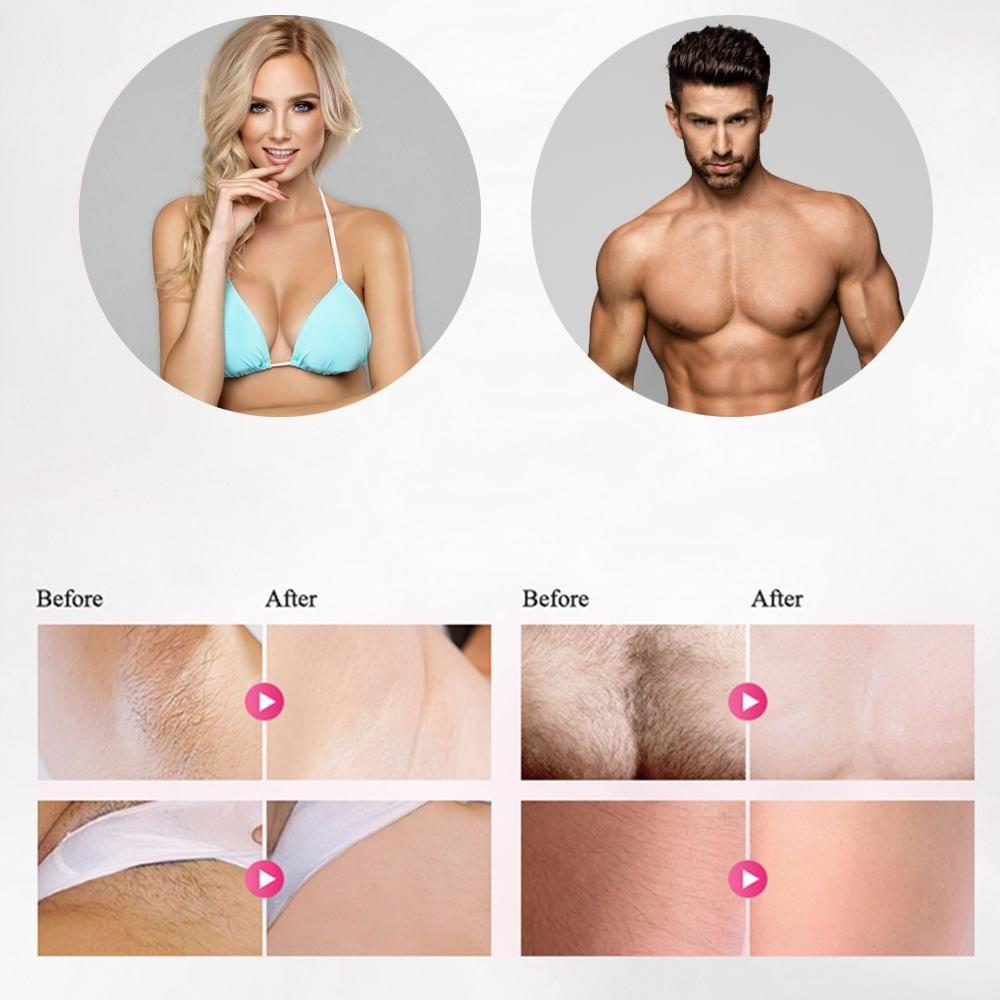 Professional IPL Epilator Laser Hair Removal
