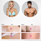 Professional IPL Epilator Laser Hair Removal