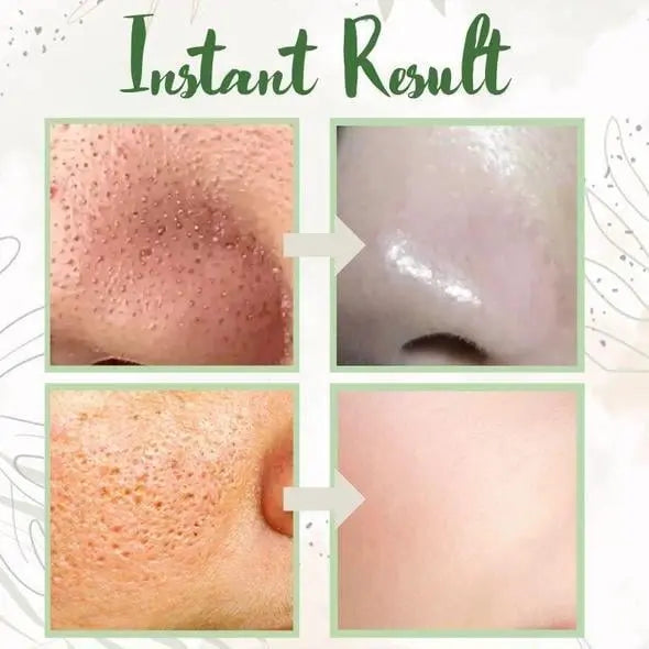 Green Tea Deep Cleansing Mask – Against Sebum, Dirt & Clogged Pores