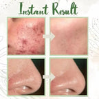Green Tea Deep Cleansing Mask – Against Sebum, Dirt & Clogged Pores