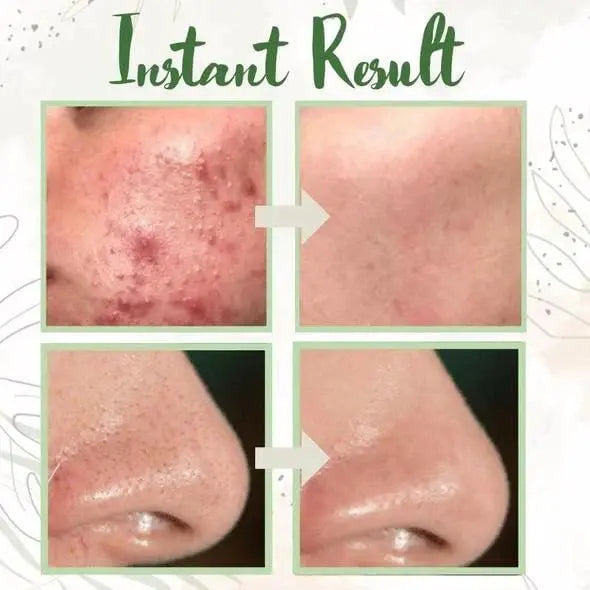 Green Tea Deep Cleansing Mask – Against Sebum, Dirt & Clogged Pores