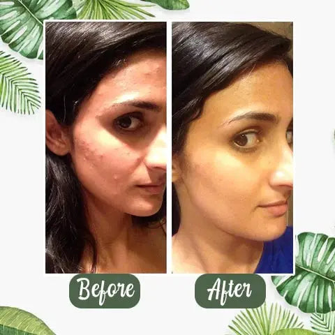 Green Tea Deep Cleansing Mask – Against Sebum, Dirt & Clogged Pores