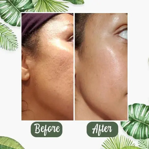 Green Tea Deep Cleansing Mask – Against Sebum, Dirt & Clogged Pores