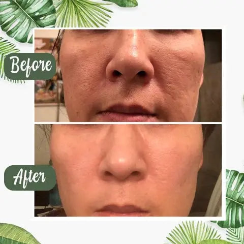 Green Tea Deep Cleansing Mask – Against Sebum, Dirt & Clogged Pores