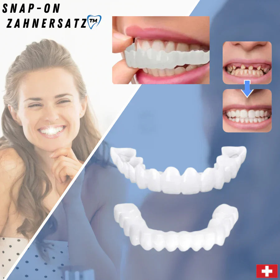 SnapFit Dental Restoration | Always a Flawless Smile