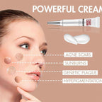 Face Freckles Removal Cream