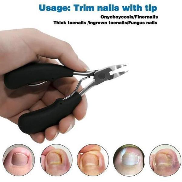 Medical nail clipper