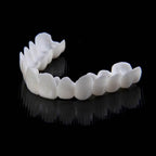 Instant Smile Transformation with Snap on Smile Veneers