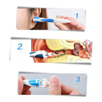 Silicone Spiral Ear Cleaner