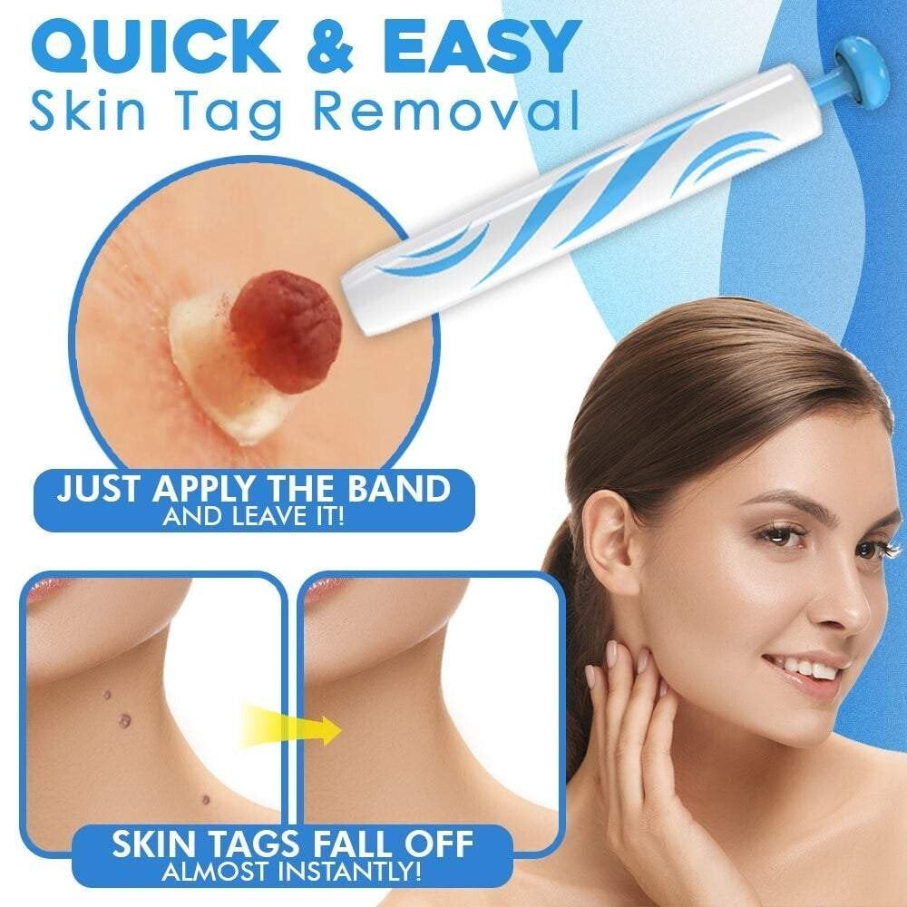 SmoothZap — Pain-free skin freedom for a new sense of confidence in just 10 days