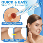 SmoothZap — Pain-free skin freedom for a new sense of confidence in just 10 days