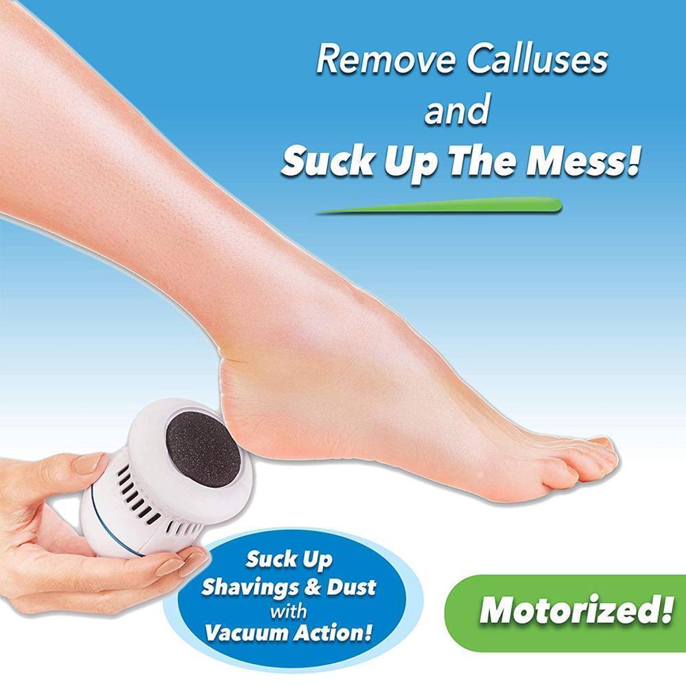 FootFile and Callus Remover