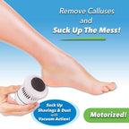 FootFile and Callus Remover