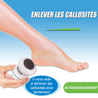 Automatic Callus Remover