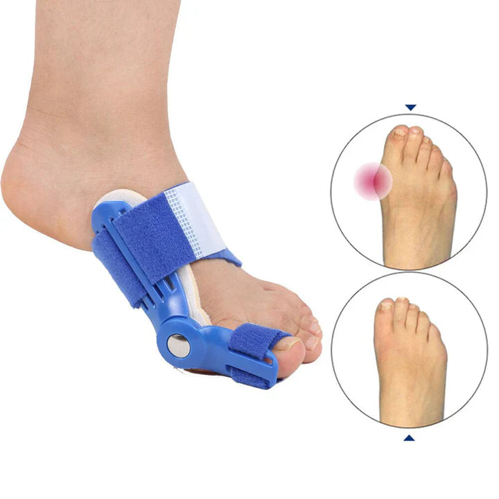 Hallux Valgus correction splint (1 pair)