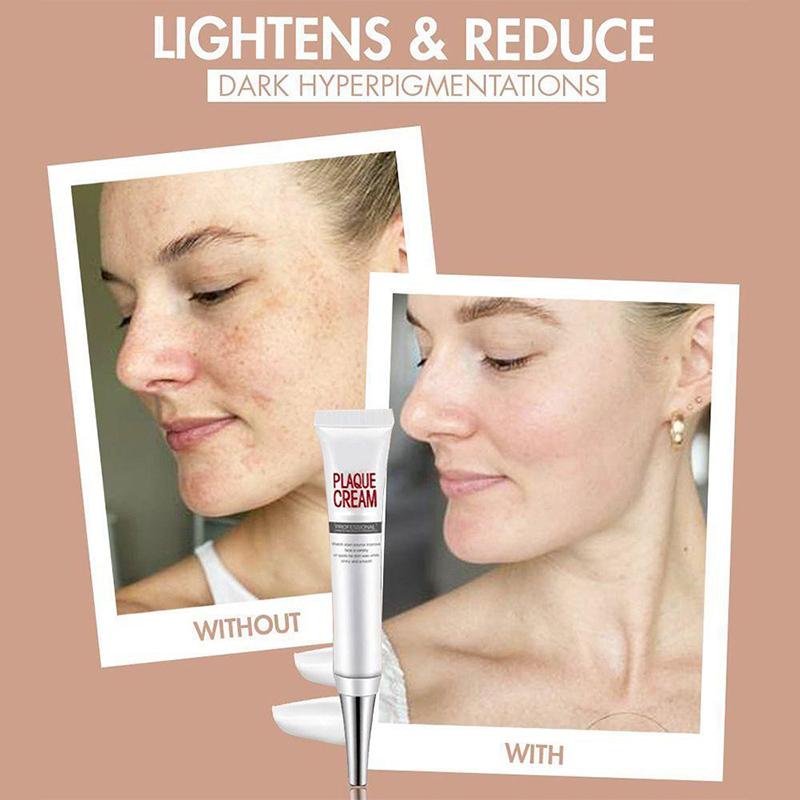 Face Freckles Removal Cream