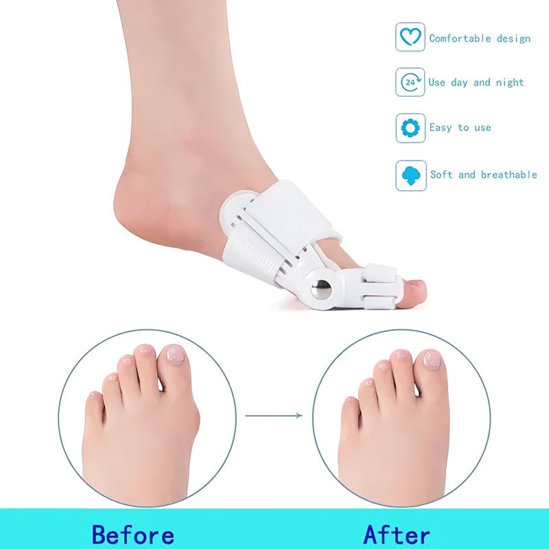 Doctor Recommended Unisex Bunion Corrector