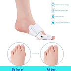 Doctor Recommended Unisex Bunion Corrector