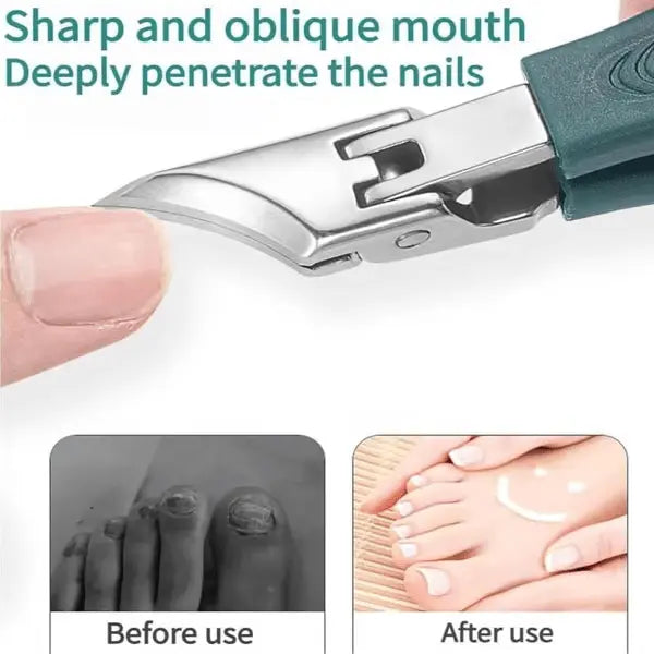 3-piece nail care set for ingrown nails