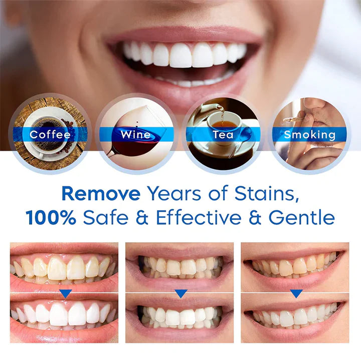 Tooth Whitening Pens