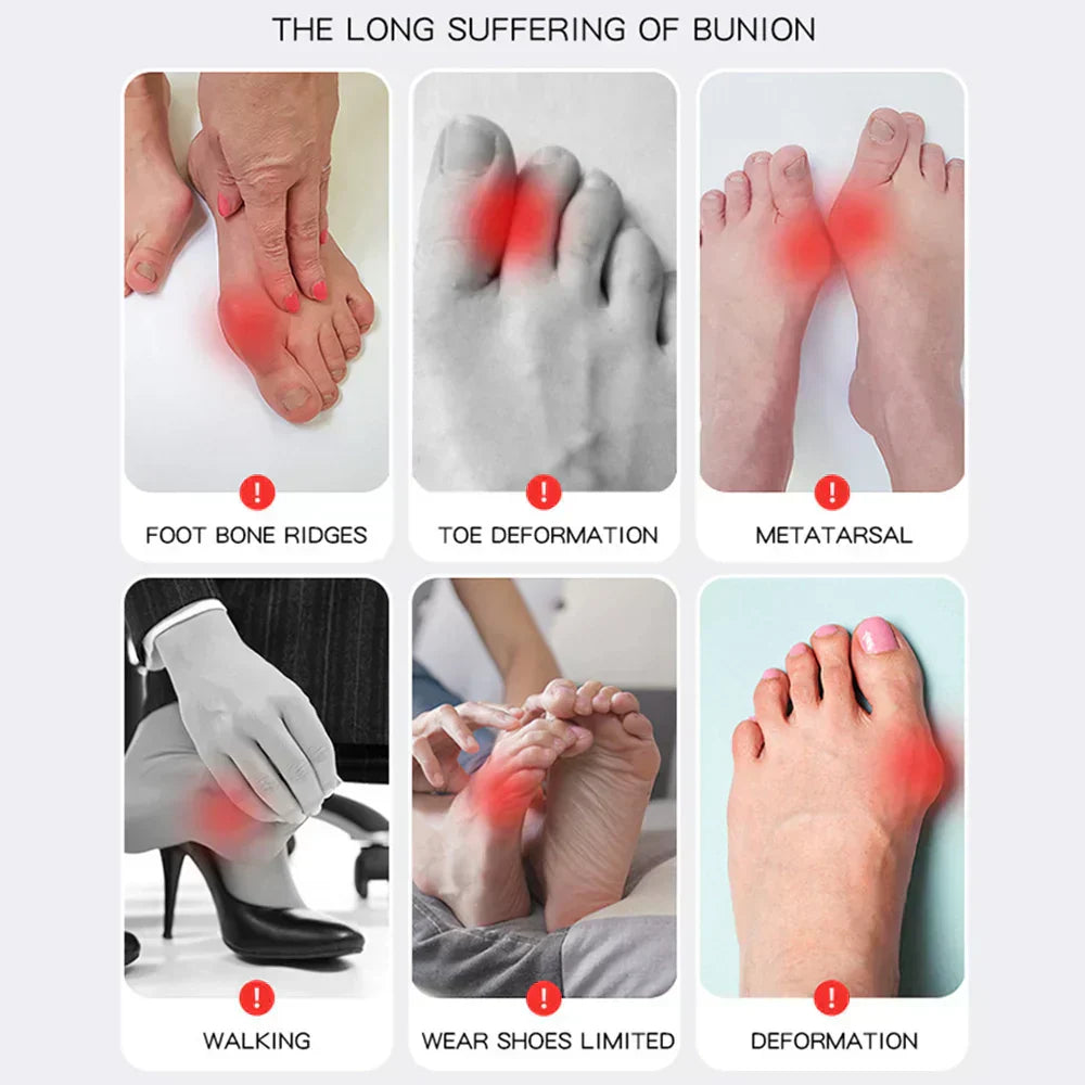 OrthoFlex – Comfortable walking with Hallux Valgus relief!