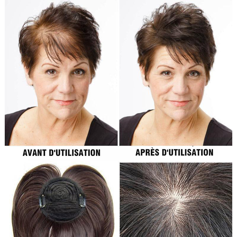 Replacement patch for wig