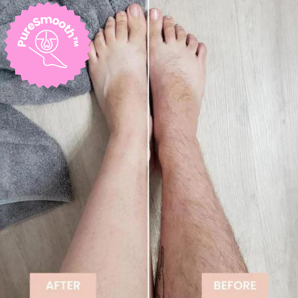 LuxeLaser Flawless Hair Removal in 60 Seconds