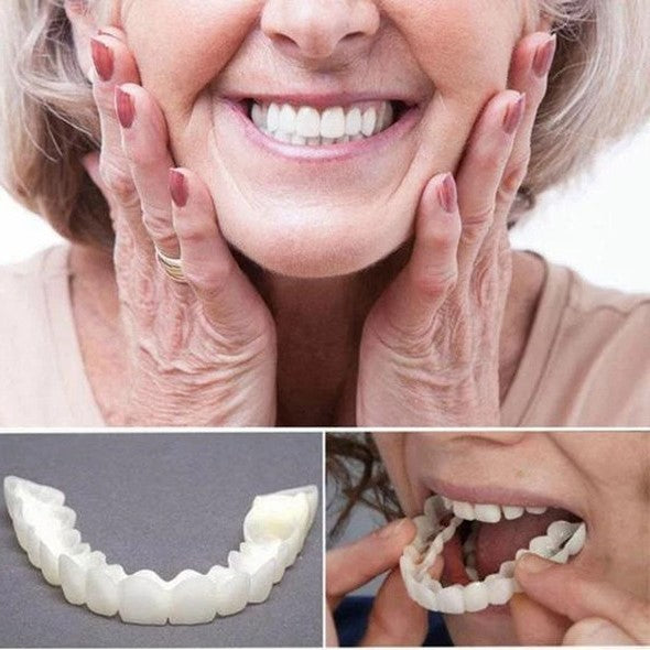 On Smile Veneers (Upper and Lower Jaw included)