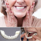On Smile Veneers (Upper and Lower Jaw included)