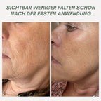YouthMorph — Tight skin in minutes for your youthful WOW moment