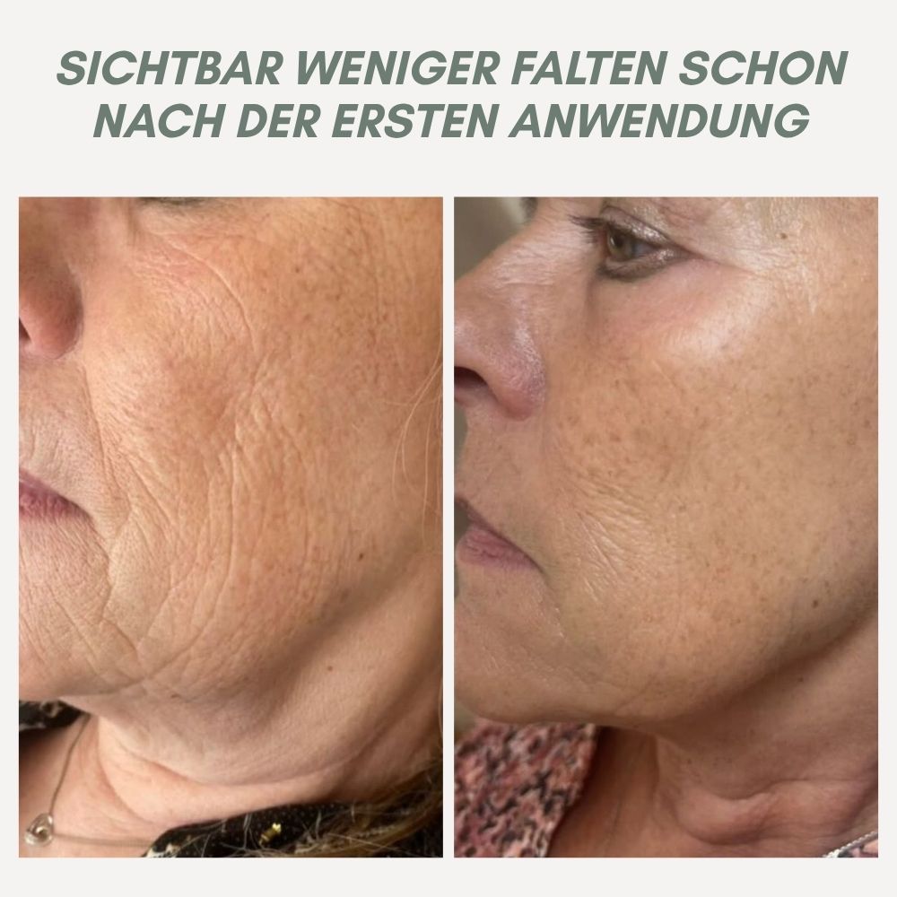 YouthMorph — Tight skin in minutes for your youthful WOW moment
