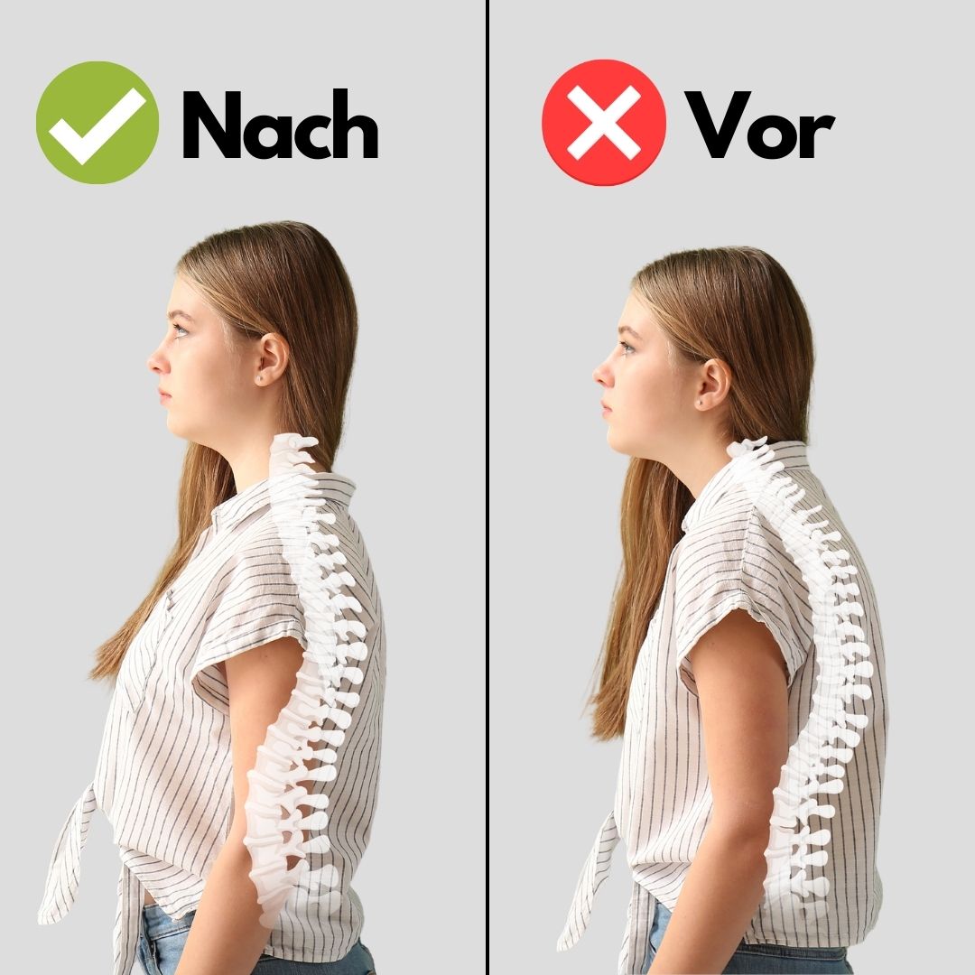 HealthPost 3-in-1 Back Posture Corrector | Adjustable Back Support for Office, Sports & Daily Life | Upper & Lower Back