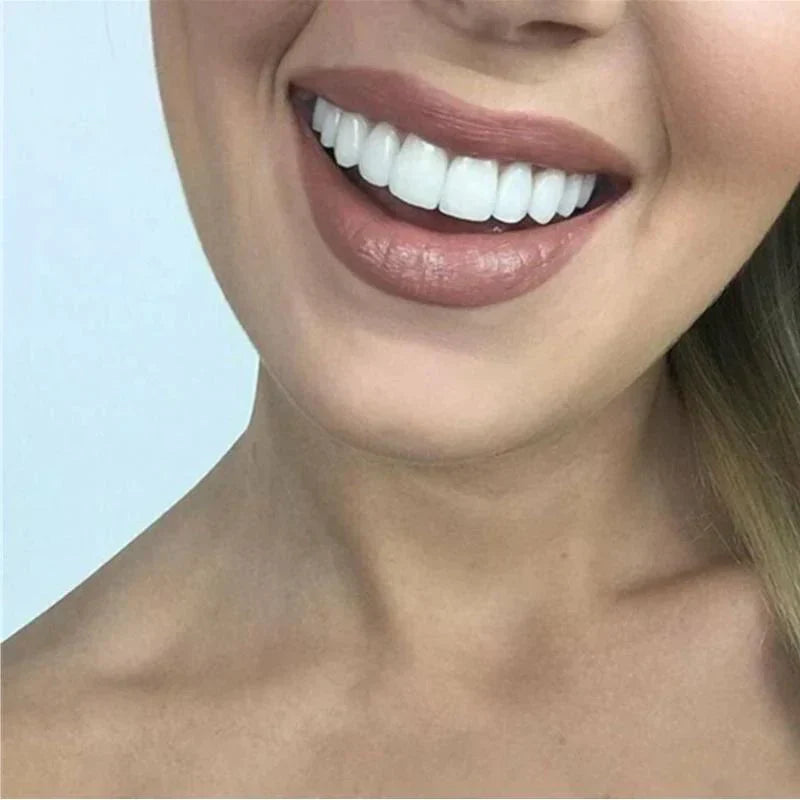 SnapFit Dental Restoration | Always a Flawless Smile