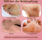 Dermashield — Quick relief for cracked, itchy feet that want to breathe freely