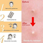 Skin Tag and Acne Patch