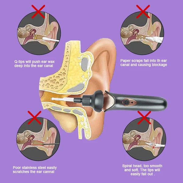 Painless Ear Wax Removal Kit – Safe & Effective Cleaning for the Whole Family