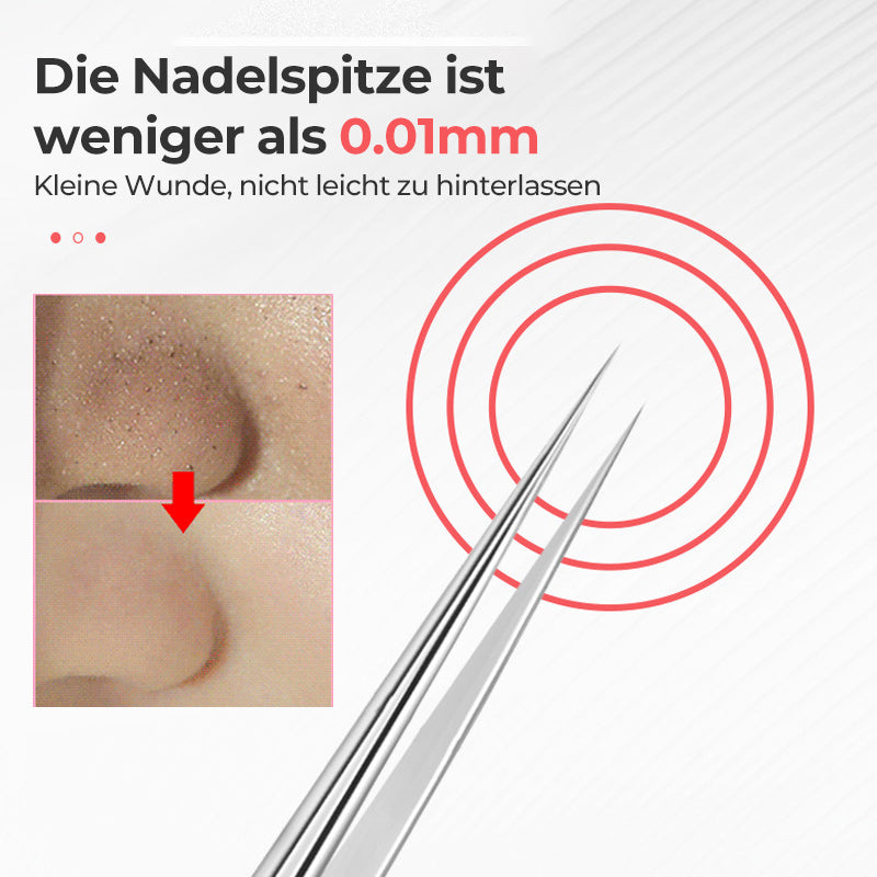 Tweezer for Removing Blackheads on the Face