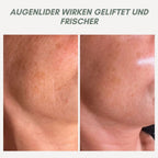 YouthMorph — Tight skin in minutes for your youthful WOW moment